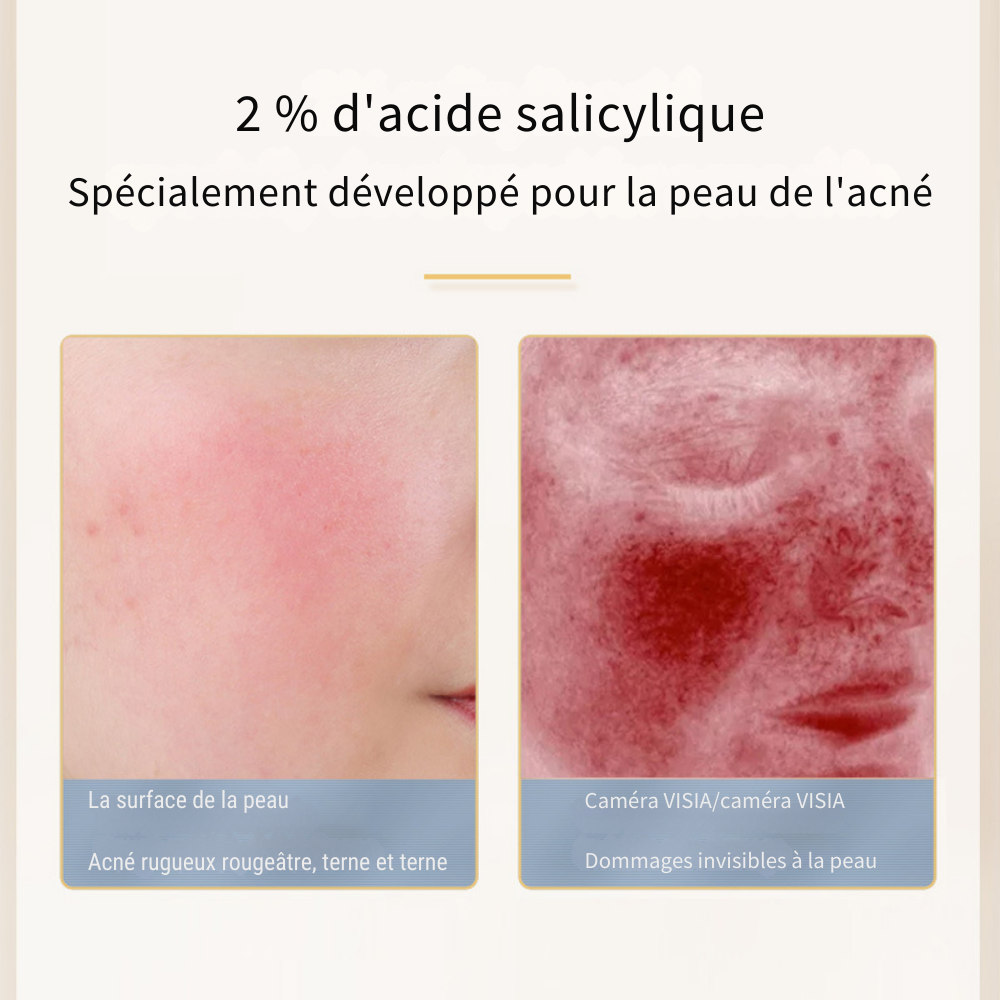 Traitements purifiants à l’acide salicylique